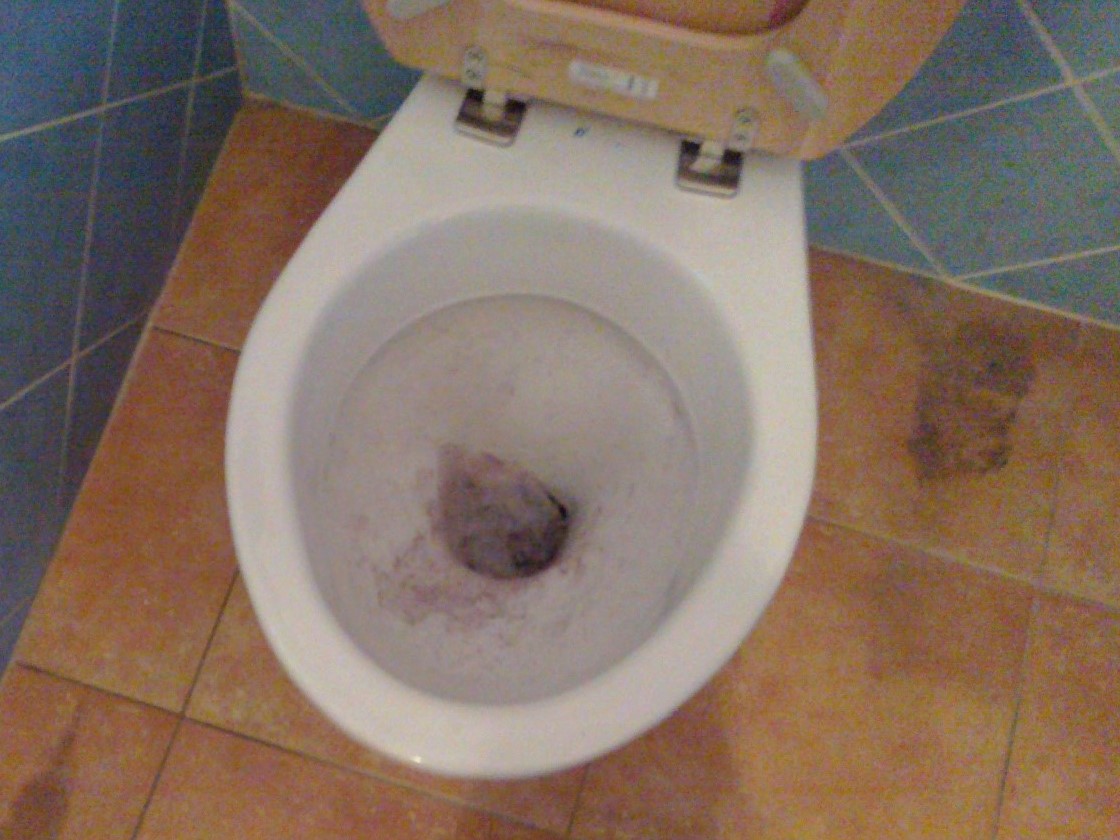 WC eldugulása Budapest VII. kerület